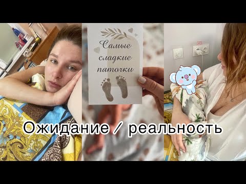 МОИ РОДЫ ПОШЛИ НЕ ПО ПЛАНУ 😰 тяжелая преэклампсия  | Экстренное кесарево 🤱🏼 у меня паралич белла