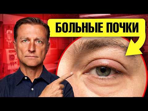 Если вы видите эти признаки — почки под угрозой