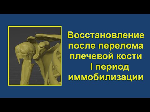 1. Восстановление после перелома верхней трети плечевой кости. Период иммобилизации.