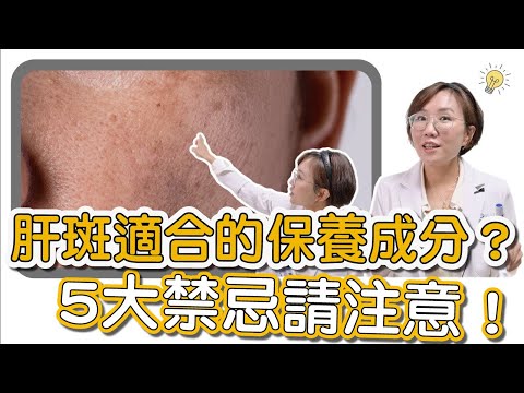 斑點都有自己名稱，最難纏的就是肝斑！肝斑怎麼產生的？你知道嗎？