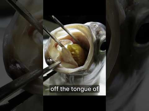 Endoparasites - Every Type of Parasite Explained