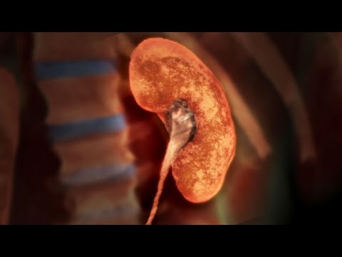 It Was Growing For 25 Years And It Ruined His Life