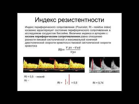 Introduction to Dopplerography. Part 2. Quantitative Doppler blood flow indices.