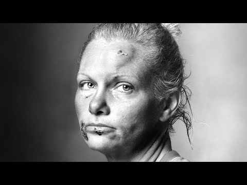 Multiple Personality Disorder (D.I.D.) Woman-Alisha