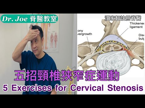 頸痛手指麻痹、腰痛腳痛麻痹、走路不穩腳步浮、尿頻、手指僵硬無力⋯⋯五招頸椎狹窄症運動[Eng Subtitles] 5 Exercises for Cervical Stenosis