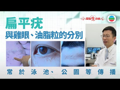 最強生命線｜扁平疣：易於公共場所感染HPV病毒　與雞眼、油脂粒的分別（繁 / 簡字幕）｜醫療｜治療｜無綫新聞｜TVB News