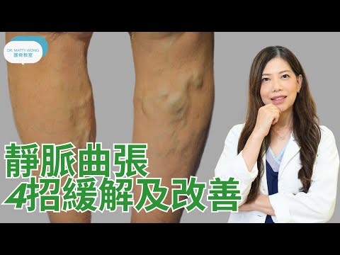 靜脈曲張 4招緩解及改善I了解原因,徵狀及治療方法 - 脊醫王鳳恩(中/Eng Sub)Exercise for relief Vericose Veins - Dr Matty Wong DC