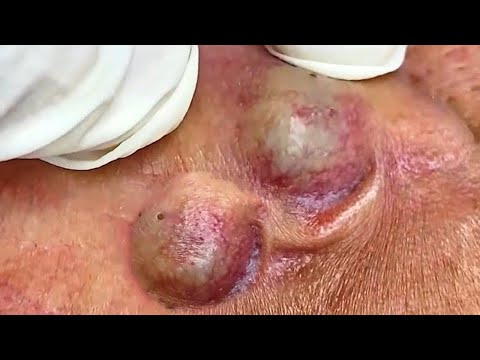 𝑺𝒐𝒐𝒕𝒉𝒊𝒏𝒈 𝑭𝒂𝒄𝒊𝒂𝒍 𝑻𝒓𝒆𝒂𝒕𝒎𝒆𝒏𝒕 𝒇𝒐𝒓 𝑺𝒕𝒓𝒆𝒔𝒔 𝑹𝒆𝒍𝒊𝒆𝒇 | 𝑫𝒆𝒆𝒑 𝑪𝒍𝒆𝒂𝒏𝒊𝒏𝒈 & 𝑪𝒂𝒍𝒎𝒊𝒏𝒈 𝑴𝒂𝒔𝒔𝒂𝒈𝒆 𝒂𝒕 𝑳𝒖𝒙𝒖𝒓𝒚 𝑺𝒑𝒂 #𝟗𝟎𝟎𝟑𝟗𝟓