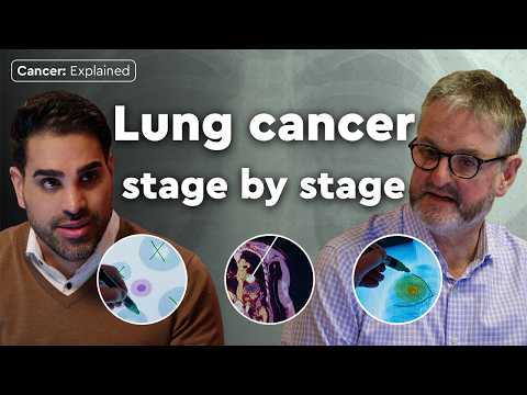 Stages of Lung Cancer Explained By Dr Ranj