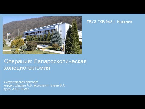 Операция лапароскопическая холецистэктомия. Хирург Шериев