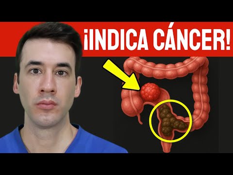 Este es el PEOR tipo de HECES - Indica Cáncer