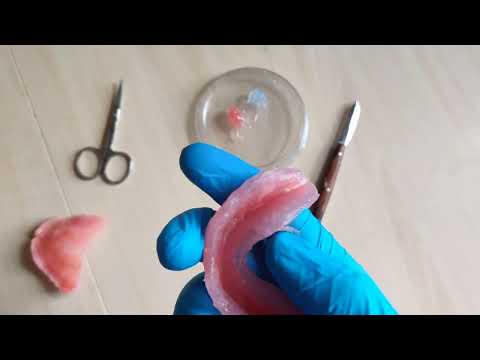 Силиконовая прокладка съёмного протеза? Набор для дома!