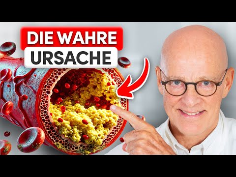 Top 8 foods to cleanse the arteries (important)