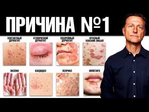 ALL skin diseases are caused by a deficiency of this...😲