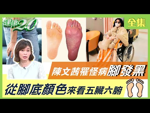 陳文茜罹怪病腳發黑 腳底顏色看五臟六腑 健康2.0 20210404 (完整版)