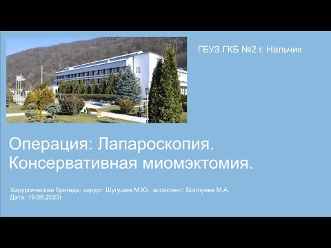 Миомэктомия консервативная операция