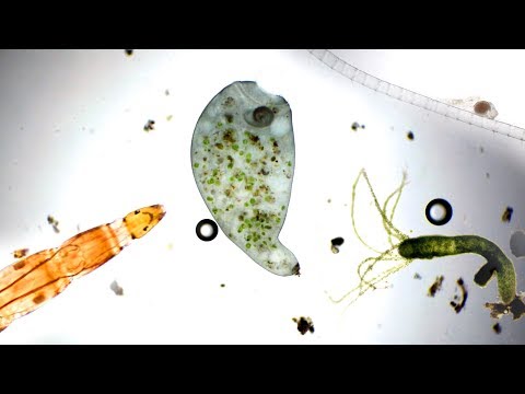 WHAT CAN YOU SEE IN A DROP OF LAKE WATER UNDER A $1,000 MICROSCOPE?