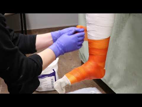 Casting Class, Lower Extremity: Foot/Ankle