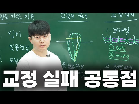 치아는 반듯해졌는데 얼굴이 늙어 보여요;; (치아교정 주의사항)