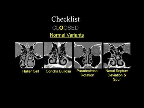 Pre-op FESS Checklist - Dr. Suresh Mukherji - Medality (MRI Online) Radiology Noon Conference