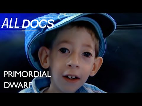 The World's Tiniest Boy 👦 | Extraordinary People Documentary | All Documentary