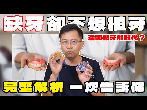 缺牙若不想植牙，活動假牙能夠取代嗎？完整解析 一次告訴你！