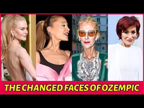 35 Celebs Suffering From Ozempic Face | Then and Now 2025