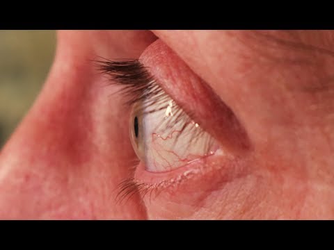 Anterior eye anatomy