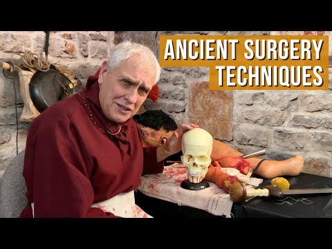 Ancient Surgery Techniques: How Civilizations Healed Wounds