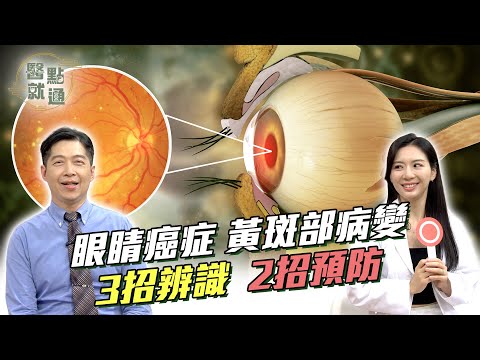 「#眼睛癌症」#黃斑部病變 ，3招辨識！2招預防！Macular Degeneration: 2 Tips!【#醫點就通】EP10(下)#緯來育樂台#海芬 ft.#李文富#魏君如｜2024.11.27