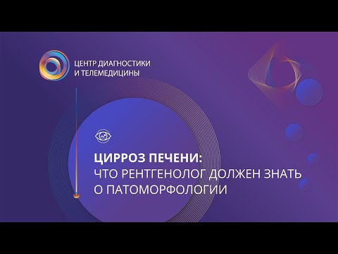 Цирроз печени: что рентгенолог должен знать о патоморфологии