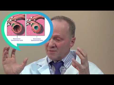 Последствия отказа от курения кашель, головокружение, головная боль, отеки, запор, ожирение