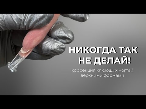 HOW NOT TO CORRECT CRACKING NAILS WITH UPPER CUTTING FORM ❌