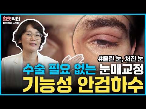 안검하수 수술 전 이건 꼭 확인해보세요( 안검하수 눈매교정 수술, 졸린 눈 처진 눈 교정 방법)