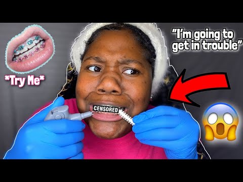 Putting my own braces on @ 2am