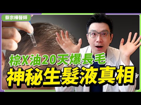 20 天長出毛!爆紅『生髮神液』哪裡買得到?真的能救禿頭嗎?
