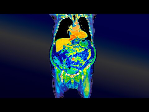 A Mom Ate Chicken Burrito From A Suspicious Restaurant. This Is What Happened To Her Gut.