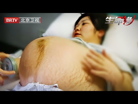 女子看自己肚子大的不正常，到医院一检查竟是三胞胎，没想到医生先慌了【生命缘之怀孕的爸爸】