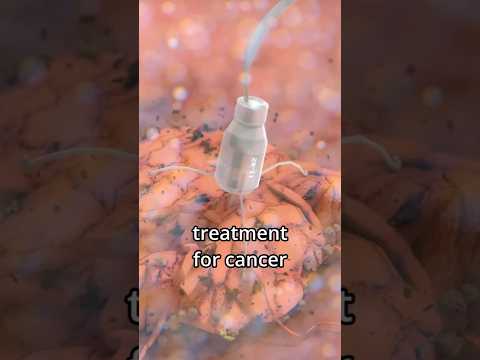 Cancer Fighting Microbots!?