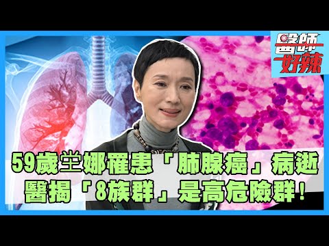 59歲坣娜罹患「肺腺癌」病逝!醫揭「8族群」是高危險群!【#醫師好辣】賈蔚 邱永林 主題特映版
