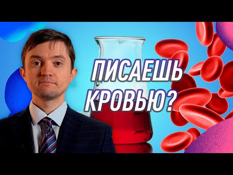 Гематурия. В чём причина и что делать?