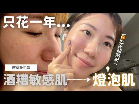 曾經酒糟大爛臉，只花一年成功逆襲光滑燈泡肌💡完整養膚醫美攻略＋保養品空空賞！｜Evanna凡娜