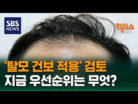[이슈빡] '탈모 건보 적용' 검토…지금 우선순위는 무엇? / SBS / 뉴스헌터스