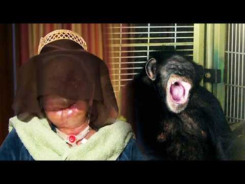 Historias Innecesarias: Travis el chimpancé y Charla Nash