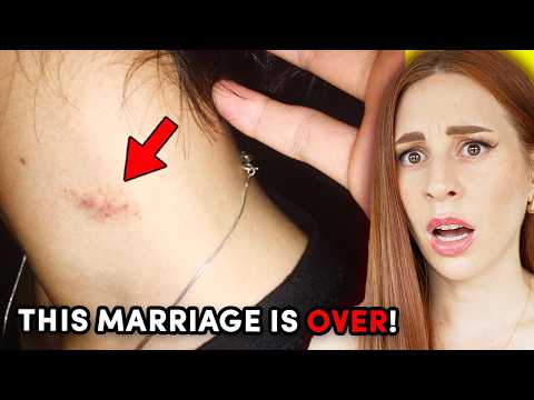 My wife returned from a work retreat with a hickey - REACTION