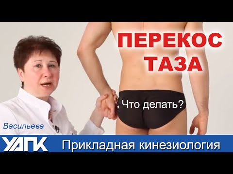 Eliminating pelvic tilt. Master class by Lyudmila Vasilyeva. Applied Kinesiology