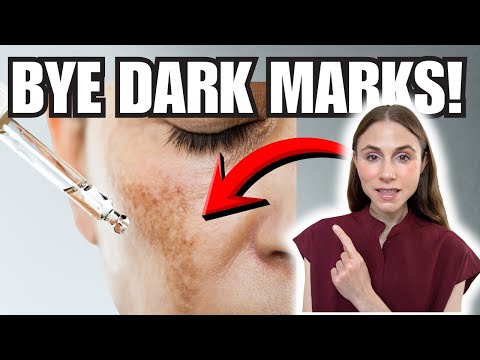 Hexylresorcinol for Hyperpigmentation: Does it Work?