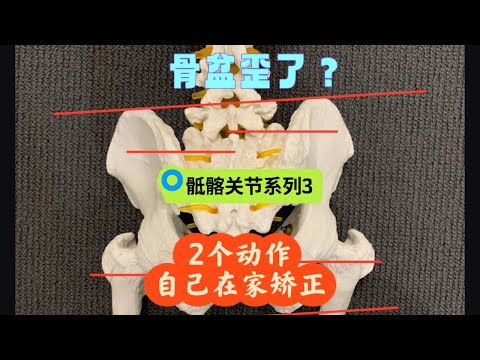 盆骨错位？教你两个动作，自己在家也能矫正！｜悉尼脊医