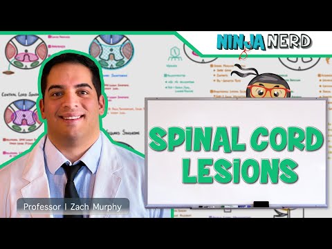 Spinal Cord Lesions: Anterior Cord, Posterior Cord, Central Cord, Brown-Séquard