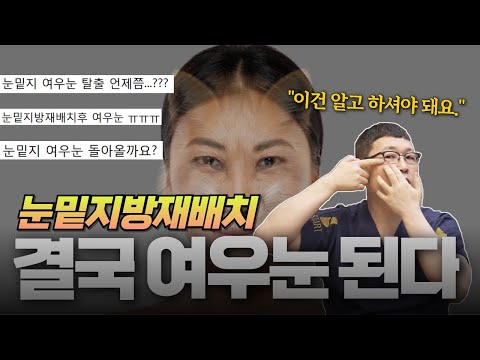 솔직히 이건 피할 수가 없습니다. 눈밑수술 10,000번 성형 전문의의 소신발언.